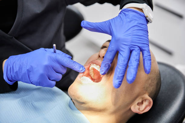 Best Urgent Care for Lost Fillings or Crowns in Burt, MI
